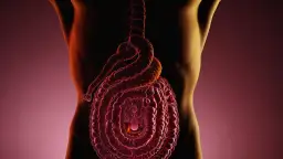 Nadżerka żołądka i dwunastnicy: 5 alarmujących objawów