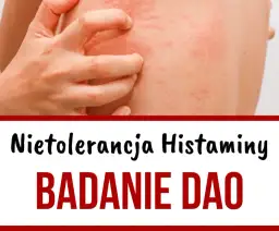 Niedobór DAO: jakie są objawy i jak diagnozować ten stan?