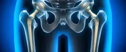 Ból stawu biodrowego objawy: Jak rozpoznać i złagodzić dolegliwości