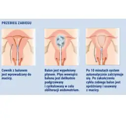 Histerektomia nadszyjkowa a miesiączka: Czy krwawienia wrócą?