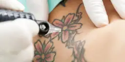 Objawy po tatuażu: Co może oznaczać ból, obrzęk i alergie?