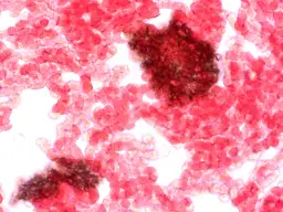 Badanie żywej kropli krwi - czy warto je wykonać?