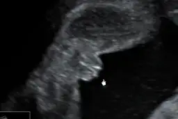 Kiedy w ciąży można poznać płeć dziecka? Oto najważniejsze informacje