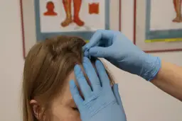 Akupunktura Tychy: Cennik 2026 i jak obniżyć koszty?