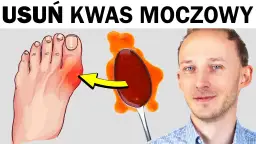 Atak dny moczanowej? Co pomoże bez recepty! Natychmiastowa ulga