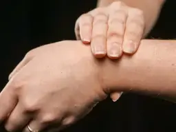 Dłoń z widocznym twardym guzem na wewnętrznej stronie nadgarstka.
