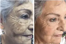 Gdzie kupić deep phyto peeling? Sprawdź najlepsze opcje i miejsca