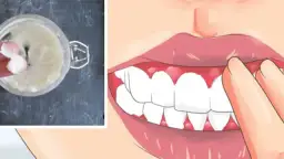 Jak stosować aloes na dziąsła, aby złagodzić ból i stan zapalny