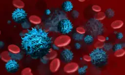 Leukämie Symptome: Warnsignale, die Sie nicht ignorieren sollten