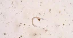 Pasożyty w ciele człowieka: Gdzie się ukrywają? Oto pełna mapa