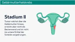 Wichtige Informationen zur Gebärmutterhalskrebs Vorsorge für Frauen