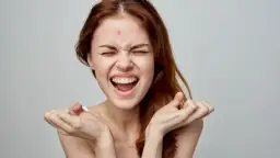 Jak szybko usunąć pryszcz? Sprawdzone metody na noc i ukrycie