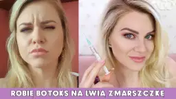 Ile kosztuje botoks na lwią zmarszczkę? Ceny w Polsce i ważne informacje