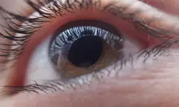 Zaćma: Jak odzyskać ostry wzrok? Objawy, leczenie, rekonwalescencja