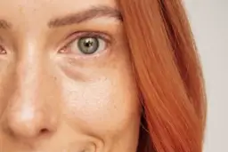 Podkrążone oczy: najczęstsze przyczyny i jak ich unikać