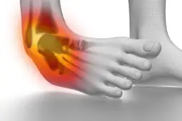 Jak długo trwa rehabilitacja po operacji stawu skokowego? Poznaj prawdę o czasie powrotu do zdrowia