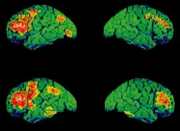Depresja czy schizofrenia? Porównanie i fakty – Matylda Kowalczyk