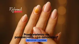 Pomarańczowe paznokcie: moda czy sygnał zdrowia?