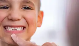 Jak leczyć krzywy zgryz od smoczka i uniknąć dalszych problemów