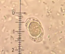 Blastocystis hominis - charakterystyka, objawy i naturalne leczenie