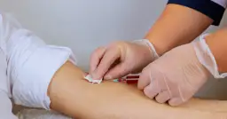 Pobieranie krwi do badania, które pomoże ustalić, jak podnieść hemoglobinę.