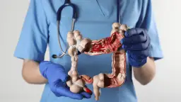 Czy rak jelita wyjdzie w badaniu krwi? Prawda o diagnozie nowotworu