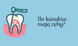 Ząb 5 ile ma kanałów? Odkryj zaskakujące różnice w budowie