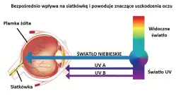 Czy telewizor emituje niebieskie światło? Sprawdź skutki dla zdrowia
