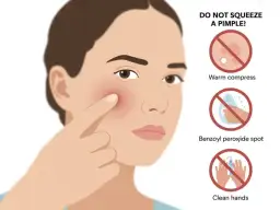 Co po wyciśnięciu pryszcza? Szybkie gojenie bez blizn