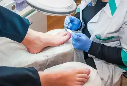 Wrastający paznokieć: Jak skutecznie leczyć? Podolog czy chirurg?