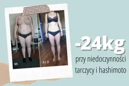 Metamorfoza: -24kg przy niedoczynności tarczycy i hashimoto. Historia sukcesu, jak schudnąć przy niedoczynności tarczycy blog.