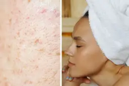 Tołpa serum rozświetlające: efekty, skład, opinie i cena