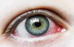 Poznaj wszystkie niebezpieczne objawy zbyt mocnych soczewek dla oczu