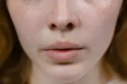 Zapchana cera: Jak rozpoznać objawy i skutecznie ją oczyścić?