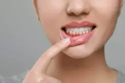 Skuteczne sposoby na opuchnięte dziąsła i kiedy udać się do dentysty