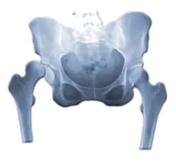 Skręcenie stawu biodrowego objawy – jak je rozpoznać i leczyć