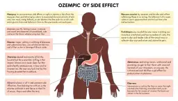 Skutki uboczne Ozempic: co warto wiedzieć o działaniach niepożądanych