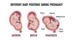 Położenie miednicowe a objawy porodu - co musisz wiedzieć?