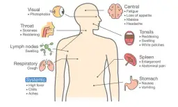 Síntoma de la mononucleosis: identifica los signos y evita complicaciones
