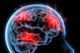 Jak powstaje udar mózgu? Poznaj przyczyny i objawy tej choroby