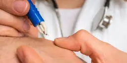 Borelioza: Ile zapłacisz za prywatne testy i co musisz wiedzieć?