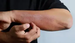 Objawy niedoboru potasu: co mówią fora, a co lekarz?