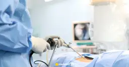 Zdejmowanie szwów z dziąsła: Czy boli? Rozwiewamy Twoje obawy