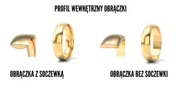 Obrączki z soczewką: co to znaczy i czy warto? Komfort na lata!