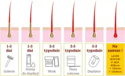 Co ile depilacja laserowa bikini? Sprawdź ceny i efekty zabiegów