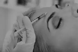 Jak przeliczyć jednostki Azzalure na Botox dla skutecznych efektów