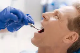 HPV w jamie ustnej: Do jakiego lekarza? Objawy i leczenie