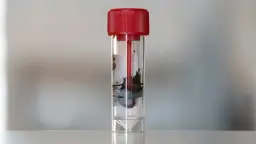 Ile kupy do badania: jak prawidłowo przygotować próbkę kału