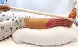 Co oznacza elewacja operowanej kończyny: praktyczne zasady unoszenia nogi