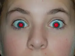 Oczy z czerwonymi źrenicami, jak po nieudanym usuwaniu czerwonych oczu.